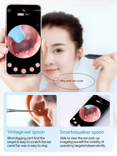 Smart Ear Cleaner with 5MP Camera – Safe Earwax Removal Tool (2026 Upgrade) 👂✨