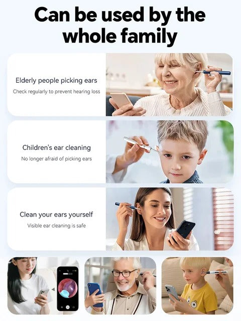 Smart Ear Cleaner with 5MP Camera – Safe Earwax Removal Tool (2026 Upgrade) 👂✨